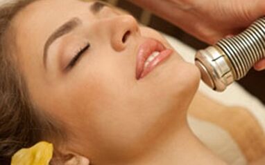 A frakcionált lézeres bőrfiatalítás előnyei és hátrányai